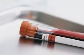 los-angeles-dui-blood-test.jpg